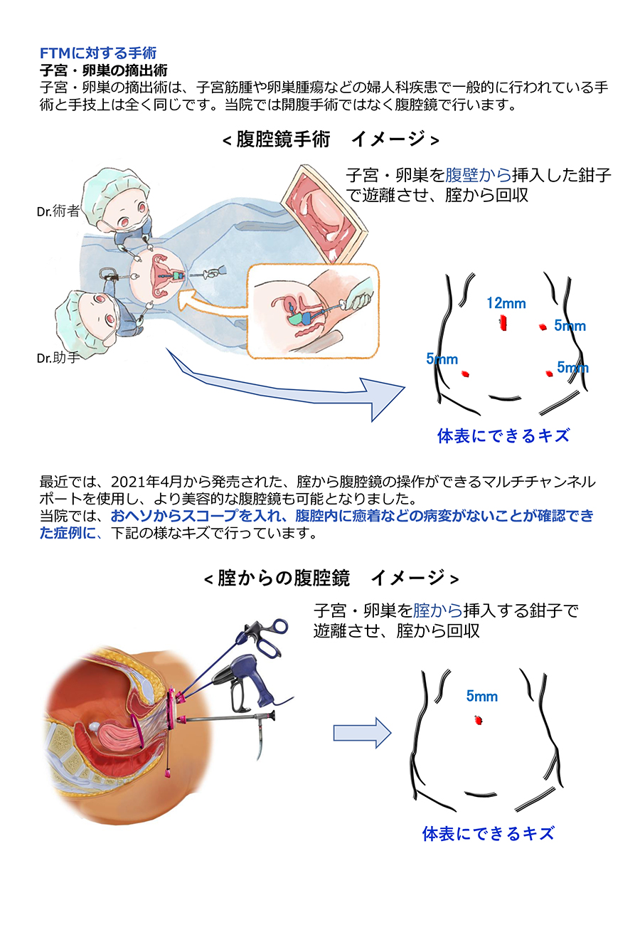 Gid 性同一性障害 治療 診療科 専門外来 医療法人明理会 行徳総合病院